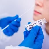 Les tests Covid-19 pris en charge à 100% par l&#039;Assurance Maladie pour les cas contacts ou les vaccinés, c&#039;est terminé