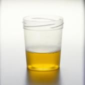 Pourquoi l’urine est-elle jaune ? 