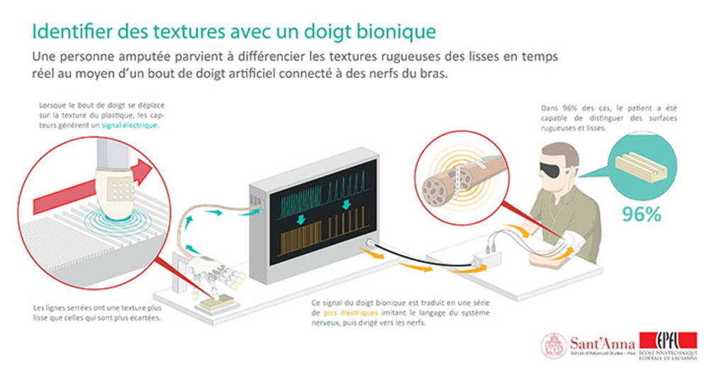 Schéma explicatif du système BionicTouch