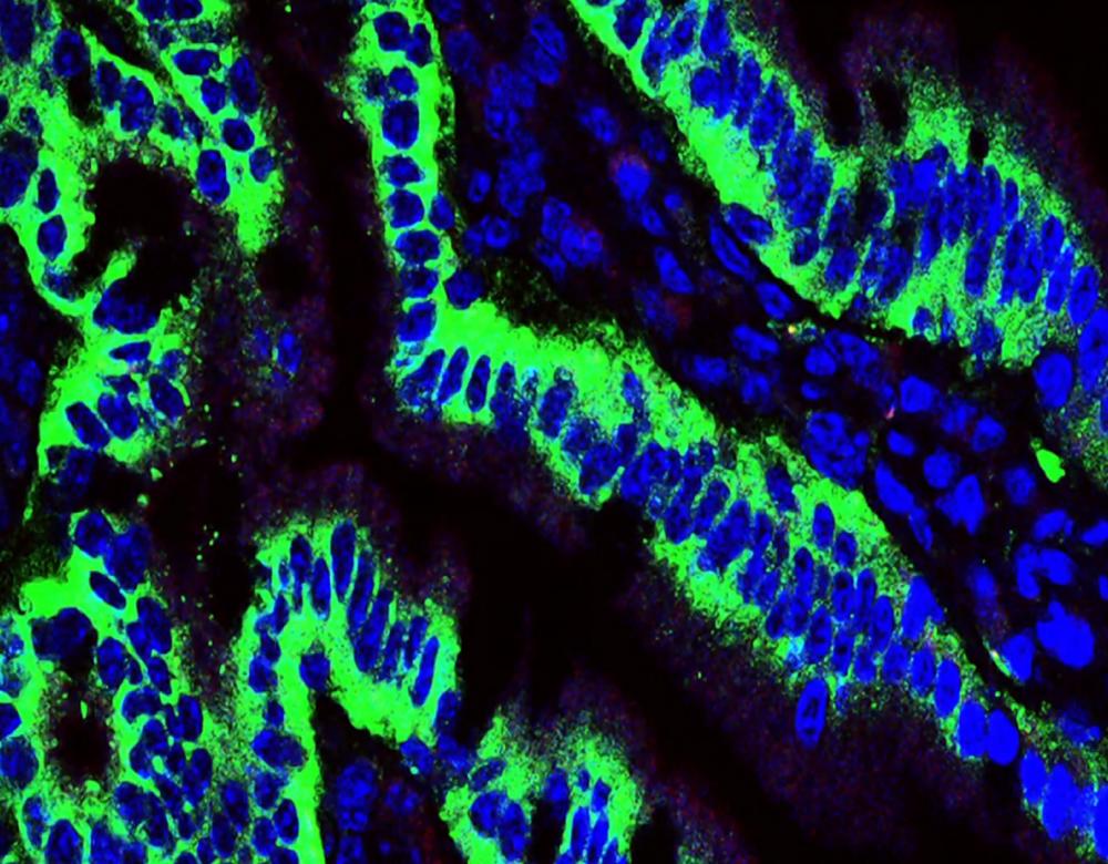 Focus Microbiote