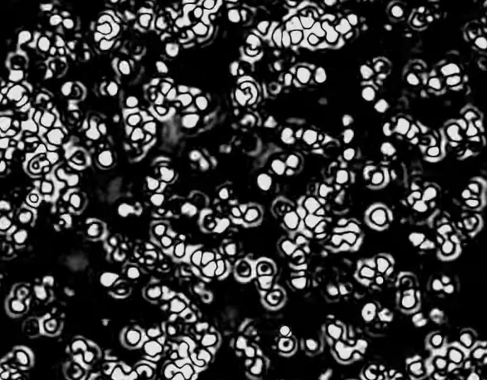 virus