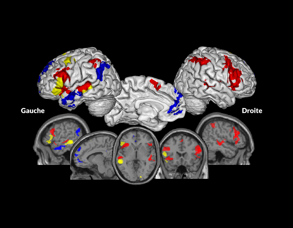 Zone cerveau