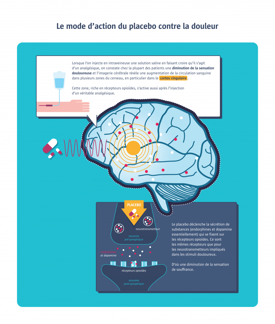infographie