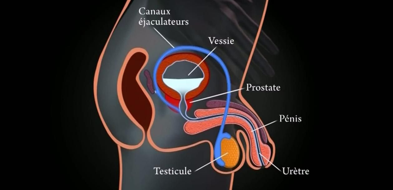 Cancer De La Prostate La Controverse Des Tests Le Blob Lextra Média 6978