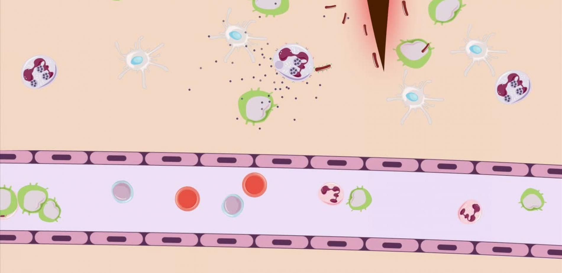 La réaction inflammatoire comme vous ne l'avez jamais vue !