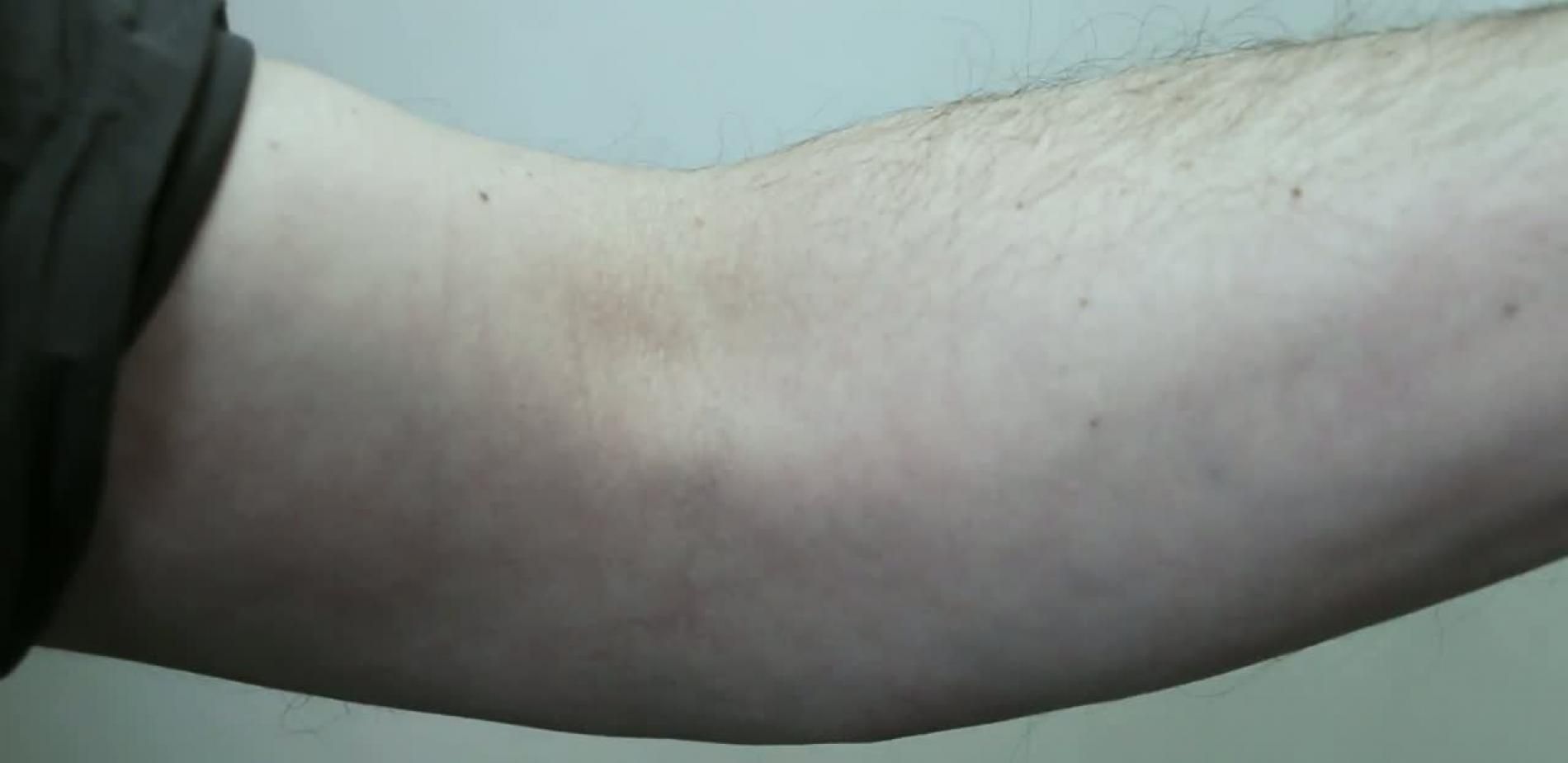 Comprendre la réparation musculaire / Isabelle Marty