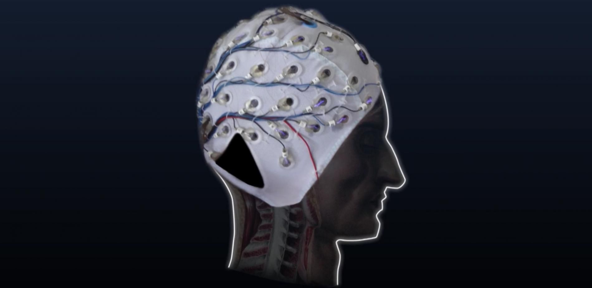 L'EEG, l'électro-encéphalographie