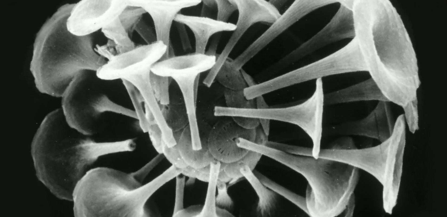 Discosphaera tubifera