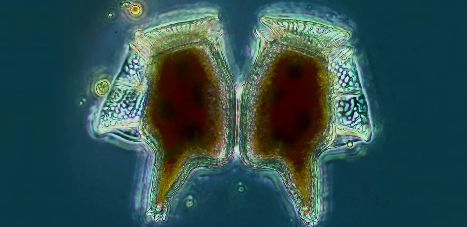 Micro-algues toxiques