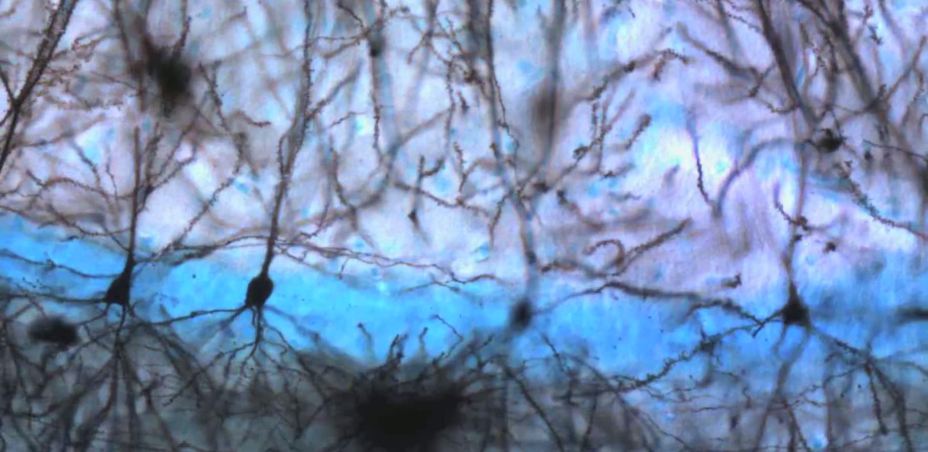 Neurone, forêt impénétrable
