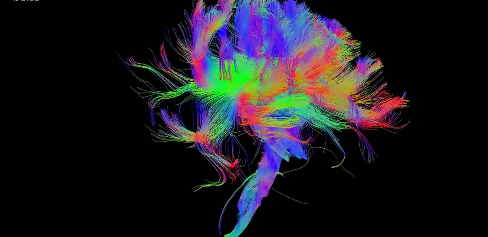Première cartographie complète d'un cerveau