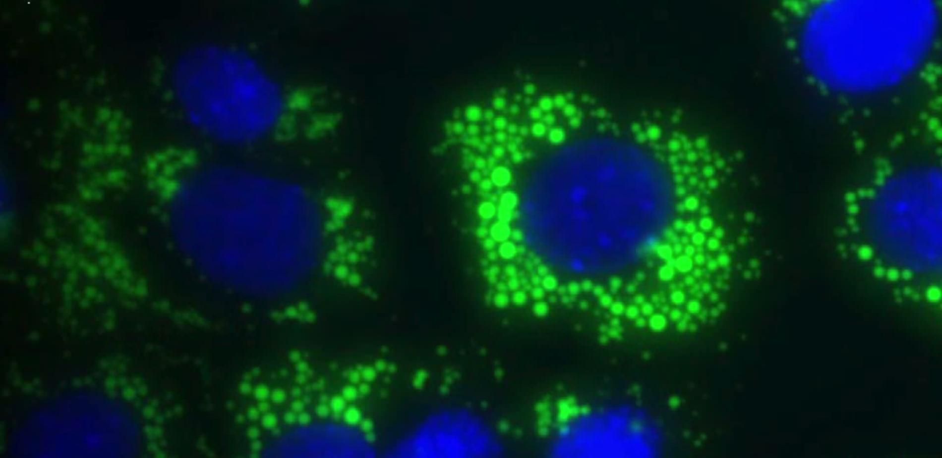 Protéine prion : ce que l'on sait