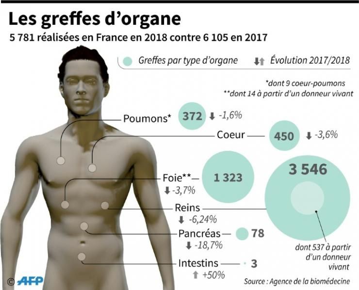 Les greffes d'organe  © AFP Jean-Michel CORNU