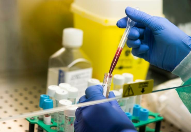 Echantillons sanguins pour des tests sérologiques, afin de vérifier si le patient a développé des anticorps, au laboratoire de l'hôpital TorVergata à Rome, le 6 mai 2020 