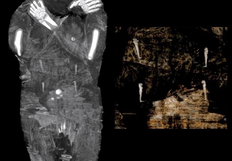 Photo diffusée le 29 avril 2021 par le "Warsaw Mummy Project" d'images radiographiques d'une momie égyptienne enceinte, le 15 décembre 2015 dans un centre médical d'Otwock, près de Varsovie, en Pologne 