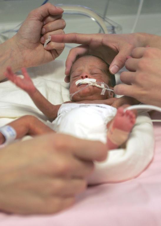 Chaque année, environ 60.000 bébés naissent en France prématurément, c'est-à-dire avant 37 semaines d'aménorrhée (8 mois et demi de grossesse), soit un toutes les huit minutes © AFP/Archives GERARD JULIEN