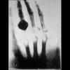 Radiographie / La main de Mme Röntgen