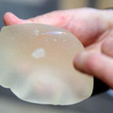 Implants mammaires PIP à explanter