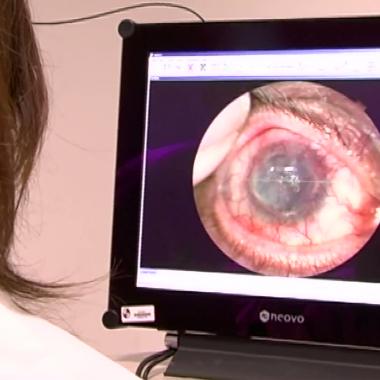 Voir la vidéo de Cornée artificielle : la greffe prend