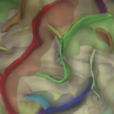 Voir la vidéo de Le cerveau à nu