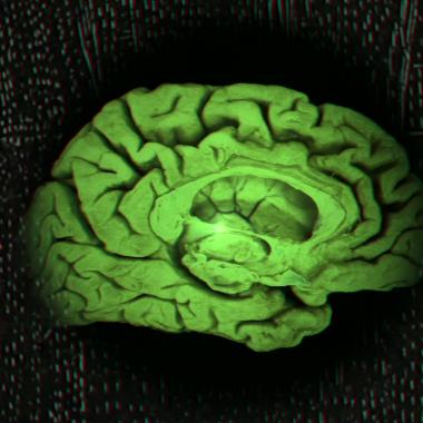 Voir la vidéo de Alzheimer, la mémoire engloutie (Version 3D)