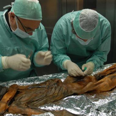 Ötzi, l'homme des glaces au coeur fragile