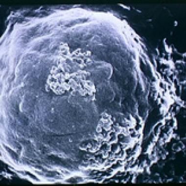 Sida : quels vaccins à l'essai ?