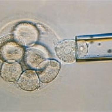 Diagnostic pré-implantatoire : polémique autour du tri d'embryons