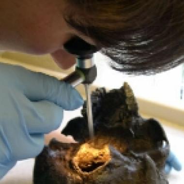 Autopsie d’un crâne de 2 500 ans