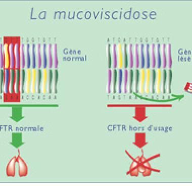 Quelle lutte contre la mucoviscidose ?