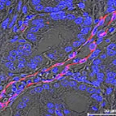 Cancer : découverte d'un récepteur biologique commun