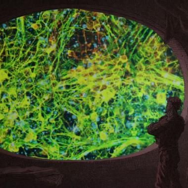 Voir la vidéo de Alzheimer, la mémoire engloutie