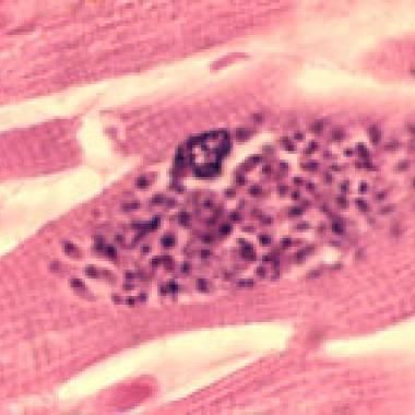 Un parasite qui pousse au suicide