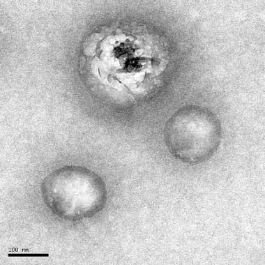 Hépatite C : le virus mis à nu