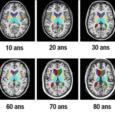 Cerveau : une évolution asexuée 