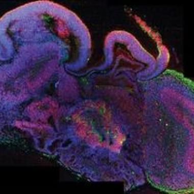 Une ébauche de cerveau créée en laboratoire