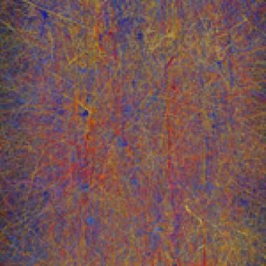 Plus d’un milliard d’euros dans le cerveau !