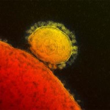 Un coronavirus meurtrier, mais peu contagieux
