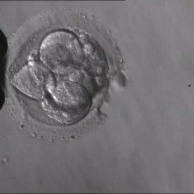 Voir la vidéo de Dessein d'embryon