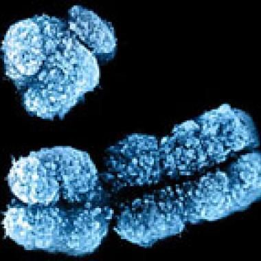 Le chromosome Y : petit mais costaud