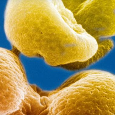 Voir la vidéo de Les allergies | Nhân-Pham Thi