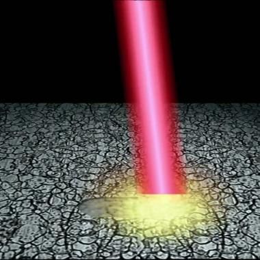 Voir la vidéo de L'alchimie du laser