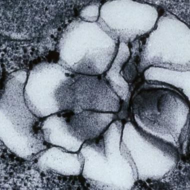 Voir la vidéo de Kupka et le lysosome