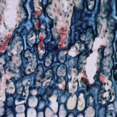 Voir la vidéo de Klimt et les ostéoclastes