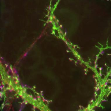 Voir la vidéo de Fluorescence du neurone