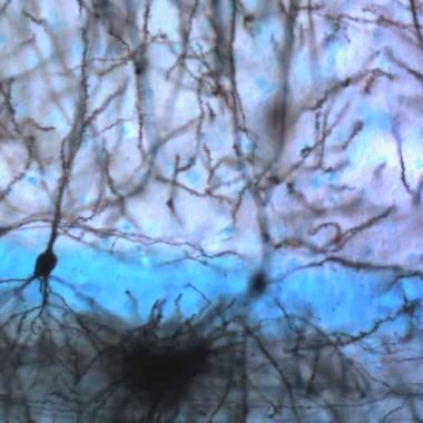 Neurone, forêt impénétrable