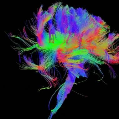Première cartographie complète d'un cerveau