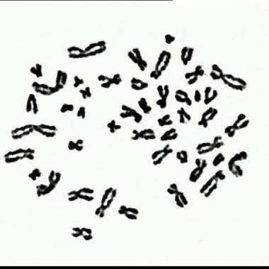 Voir la vidéo de Microscope optique / 1er caryotype