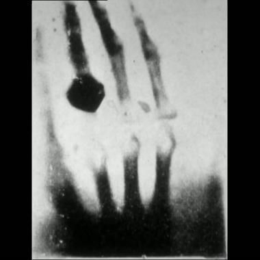 Voir la vidéo de Radiographie / La main de Mme Röntgen