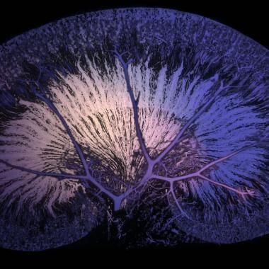 Voir la vidéo de Kidney, the filter of life